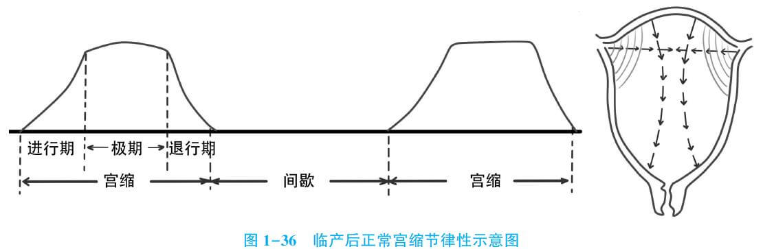 注意:宫缩必须有间歇,且宫缩间歇子宫必须完全放松,以便子宫,胎盘
